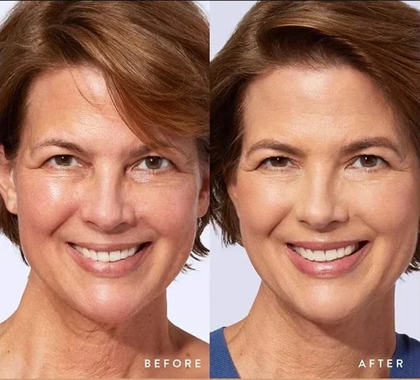 🔥2026 Hot Sale 50% OFF✨⚡ 50K+ SOLD! 🎁4-in-1 Perfecting Foundation – High Coverage, SPF & All-Day Hydration 🤍✨