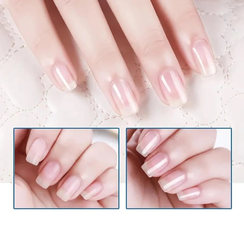 💝LAST DAY - BUY 1 GET 1 FREE!!💝3 Days Nail Care - Keratin Amino Acid Formula, Suitable for Soft and Fragile Nails