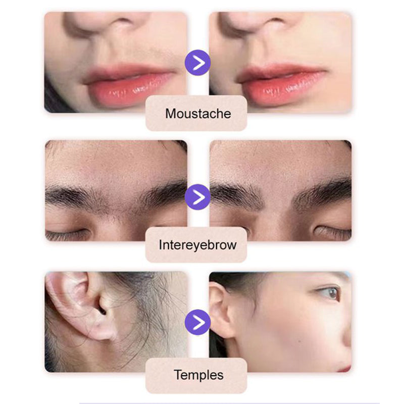 💗Last Day Special Price £7.99 ! 🔥Buy 3 Get 2 Free🔥Gentle & Painless Facial Hair Removal Cream
