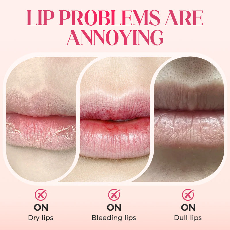 📢📢Buy 2 Get 1 Free !! ⏰50K+ SOLD!✨Nooni Apple Hydrating Moisturizer Plump Transfer-proof Glossy Lip Stain Oil💋